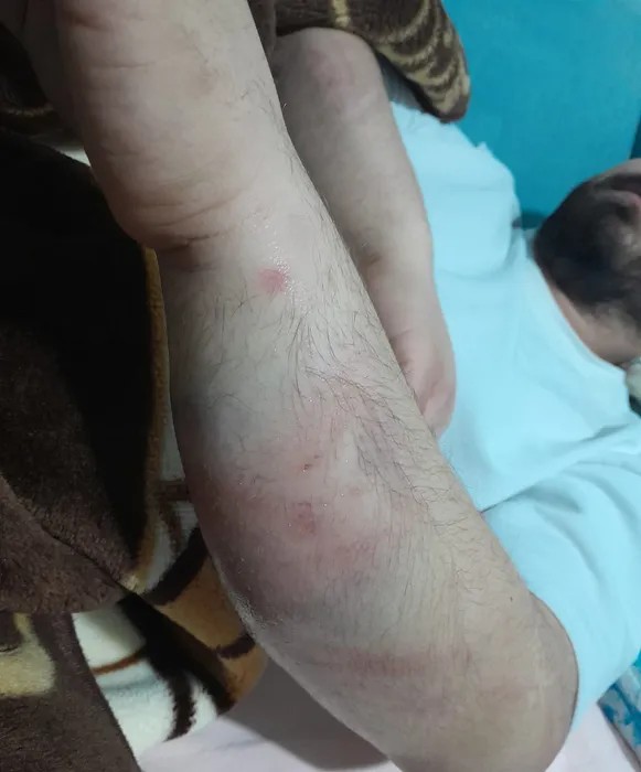 24 Milyonluk Borç Kabusa Dönüştü! Mafya Aracılığıyla Darp Ve Tehdit